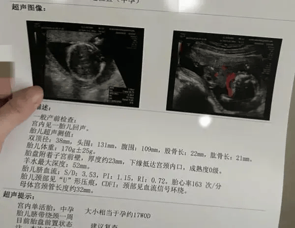 00后代孕流产女孩发声，昆山成立调查组，女孩已安排照顾